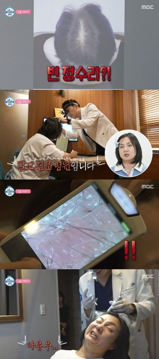 박나래가 남성형 탈모 진단에 충격을 받았다.  MBC ‘나 혼자 산다’ 방송화면 캡처