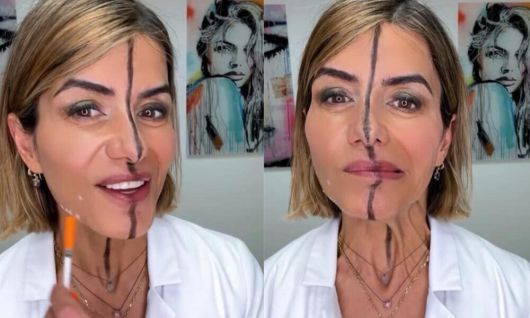 한 미국의 여의사가 자신의 얼굴에 보톡스 실험을 진행한 영상. 인스타그램 캡처