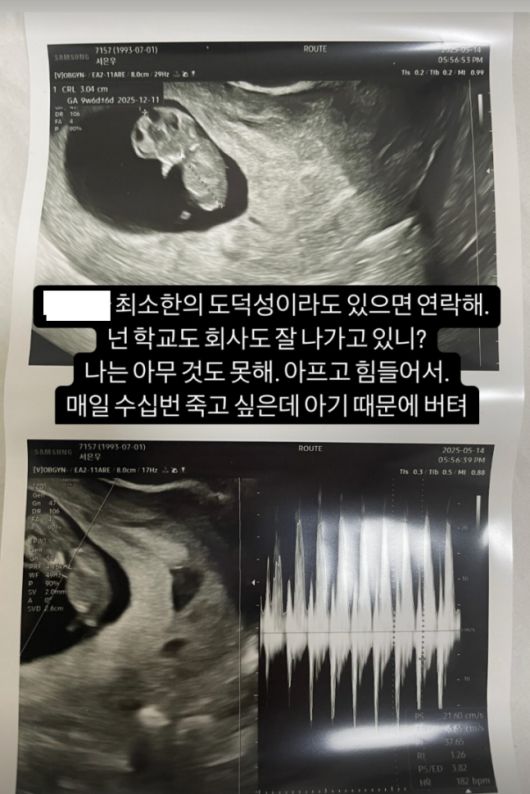 서은우 씨가 지난 17일 사회관계망서비스(SNS)에 공개한 초음파 사진. 서은우 인스타그램