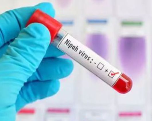 ‘니파바이러스’ 감염증이 국내에서 제1급 법정 감염병으로 지정된다. 게티이미지뱅크