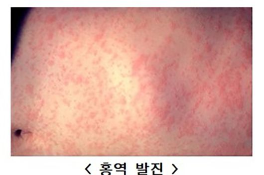 질병관리청 제공