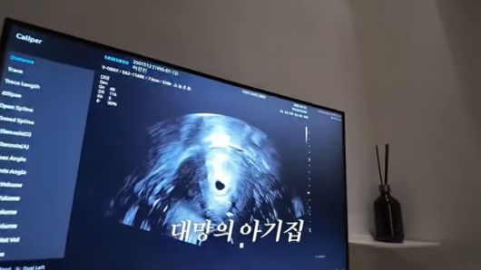 이날 초아는 쌍둥이 임신 소식을 공개했다. ‘초아라이프’ 유튜브 캡처