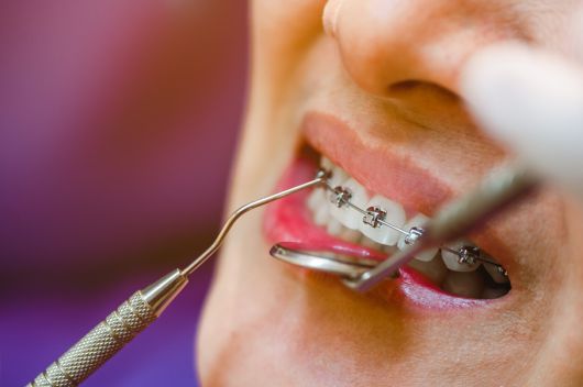 치과 치료 관련 사진. 게티이미지뱅크