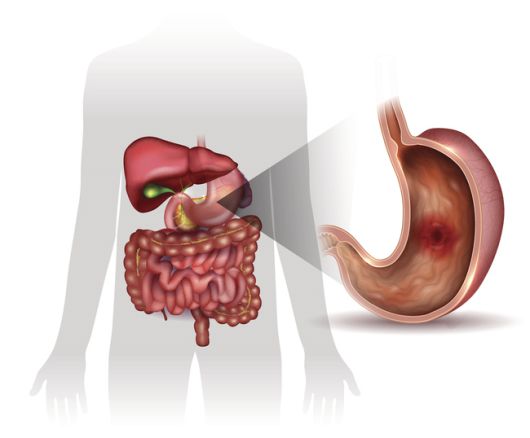 보이지 않는 염증을 관리하는 것이 건강 수명을 늘리는 가장 현실적인 방법이다. 게티이미지