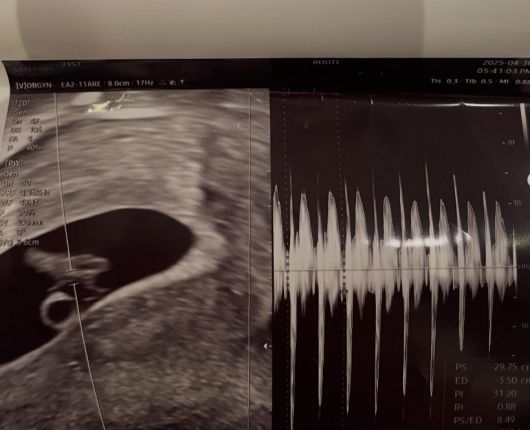 사진=서민재 SNS