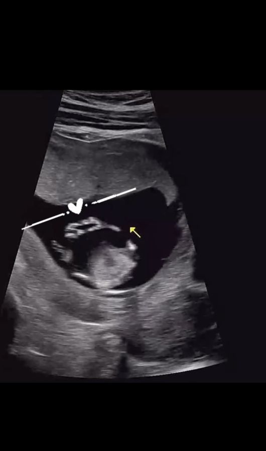 배우 박가령이 결혼 2년 만에 임신 소식을 전했다.  사진 = 박가령 SNS 계정