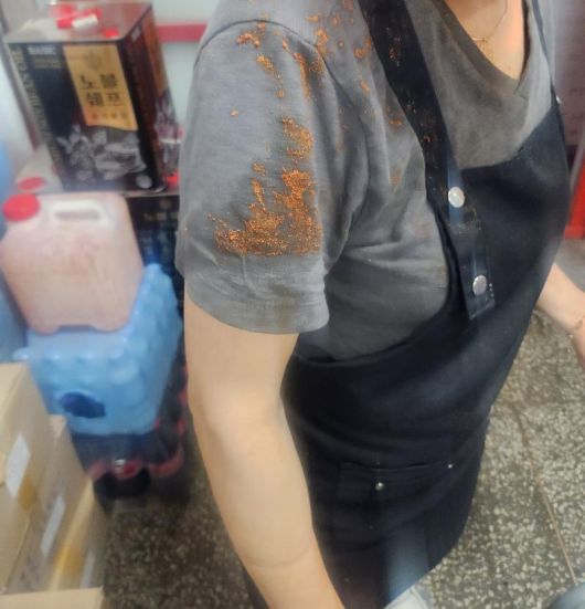 A 씨의 어머니가 피해를 받은 사진. 온라인 커뮤니티 ‘보배드림’ 캡처