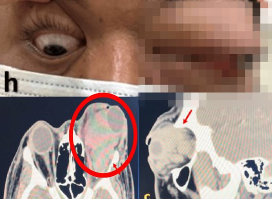 사진=Cureus 캡처.