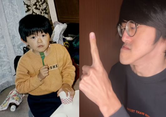 비정상적으로 긴 턱 때문에 놀림을 받았던 일본 남성 ‘조노우치’가 이를 개성으로 삼아 셀프 브랜딩에 성공했다. 턱이 다섯 살 무렵부터 자라기 시작해 학창 시절 놀림과 연애 거절까지 겪었지만, 지금은 “세계에서 가장 긴 턱을 가진 유튜버”를 자처하며 유튜브 35만 명, 틱톡 등 다른 플랫폼에서 약 41만 명의 팔로워를 끌어모았다. (사진=틱톡)