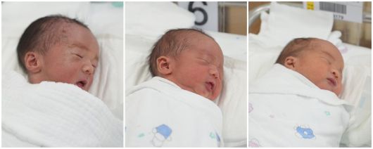 분당서울대병원 제공