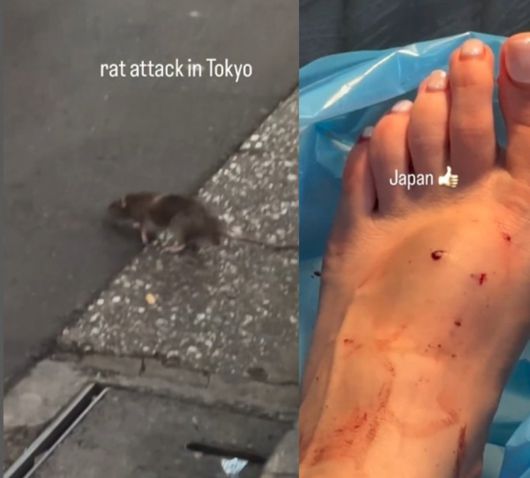 도쿄 신주쿠 거리에서 쥐에 발을 물린 해외 관광객이 공개한 상처 사진. 출처=인스타그램 ‘@yogitutty’ 캡처