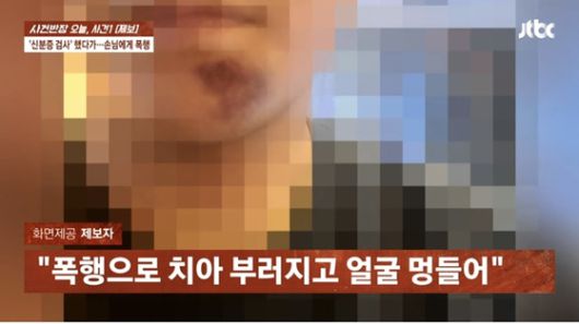 술집에서 신분증 검사를 했다가 손님에게 폭행을 당해 치아가 부러지고 턱 쪽에 멍이 심하게 든 직원 모습. 〈사진=JTBC '사건반장'〉
