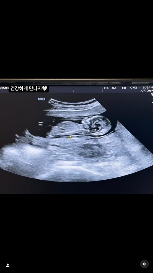 텐아시아