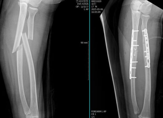 사진=오윤아 SNS