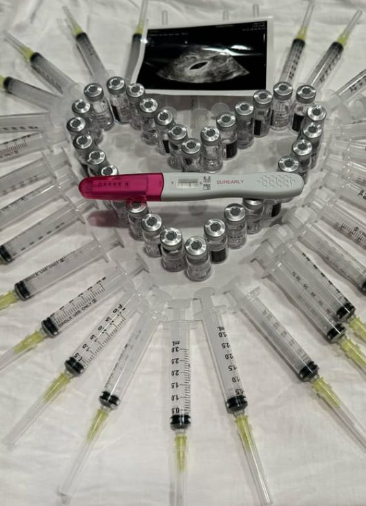 사진=아야네 SNS