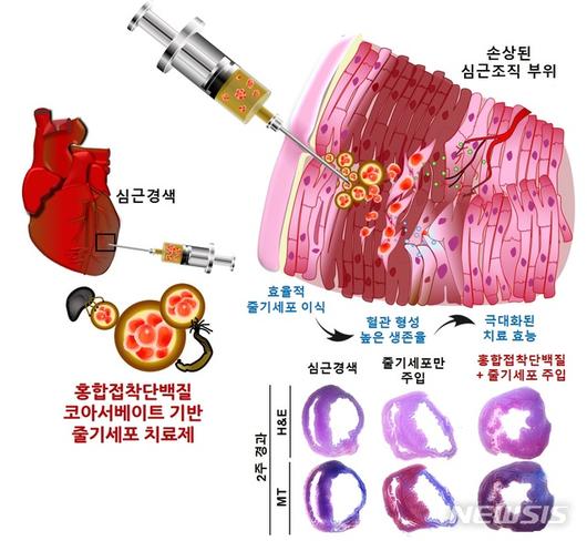 뉴시스