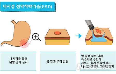 뉴시스