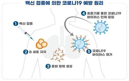 뉴시스