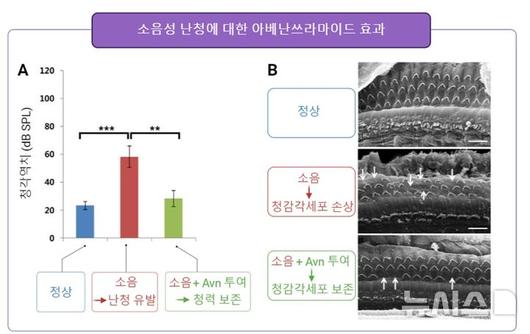 뉴시스