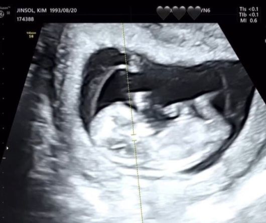 [서울=뉴시스] 트루디가 임신 소식과 함께 태아 초음파 사진을 공개했다. (사진=트루디 인스타그램 캡처) 2025.05.09. photo@newsis.com  *재판매 및 DB 금지