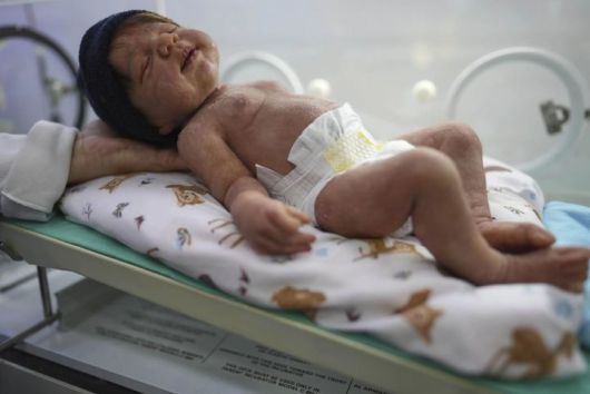 [상파울루=AP/뉴시스] 브라질 캄피나스의 한 매장에서 판매 중인 리본돌이 인큐베이터에 누워 있다. 2025.05.24 photo@nesis.com *재판매 및 DB 금지