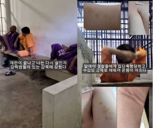 [뉴시스] 멍든 A씨의 모습. (출처=A씨 인스타그램) *재판매 및 DB 금지