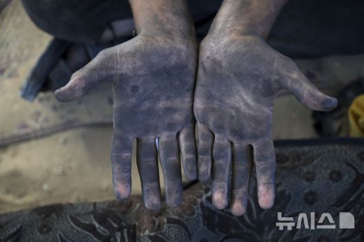 [가자시티=AP/뉴시스] 지난 22일(현지 시간) 가자지구 가자시티 남쪽 시로드에서 한 팔레스타인 남성이 플라스틱을 녹여 연료를 추출하는 작업을 하면서 본인 손을 보여주고 있다. 팔레스타인 청년들은 플라스틱 폐기물을 금속 드럼에 넣고 가열해 만든 연료를 병에 담아 판매하며, 이는 현지에서 발전기나 이동용 연료로 사용된다. 유독한 연기와 불길에 노출되는 고된 작업이지만, 이들에게는 가족의 생계를 이어가는 거의 유일한 수단이다. 2025.06.25.