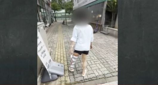 [뉴시스] B씨는 곧바로 병원으로 이송돼 왼쪽 무릎 신경과 인대 파열, 양손 골절 등의 중상을 입고 전치 6주 진단을 받았다. 피부이식 수술을 받았으나 신경 검사, 성형 수술 등이 남아 있어 치료 기간이 얼마나 걸릴지 알 수 없는 상황이다. 지금까지 치료비만 1300만원가량 나온 것으로 전해졌다. (사진=JTBC '사건반장' 캡처) *재판매 및 DB 금지