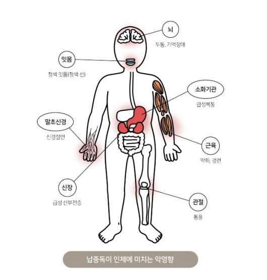 [서울=뉴시스] 9일 식품의약품안전처가 발간한 '유해물질 간편정보지'에 따르면 납은 소화관에서 흡수율이 높아 오랫동안 섭취하면 사람의 장기나 조직에 쌓여 건강을 해칠 수 있다. (사진=식약처 제공) 2025.07.09. photo@newsis.com *재판매 및 DB 금지