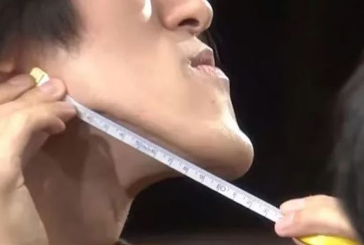 [서울=뉴시스] 10㎝가 넘는 긴 턱으로 인해 어린 시절 어려움을 겪었지만, 조노우치는 자신의 개성으로 승화시켰다.(사진=SCMP 캡처) 2025.07.16 *재판매 및 DB 금지