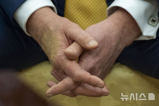 [워싱턴=AP/뉴시스] 지난 16일(현지 시간) 도널드 트럼프 대통령이 백악관 집무실에서 살만 빈 하마드 알 칼리파 바레인 왕세자 겸 총리와 회담하고 있다. 트럼프 대통령은 이날 손 멍 자국을 가리기 위해 화장품을 덧발랐다. 올해 79세인 트럼프 대통령이 종아리 붓는 증상으로 종합 검진한 결과 만성 정맥부전을 진단받았다. 2025.07.18.