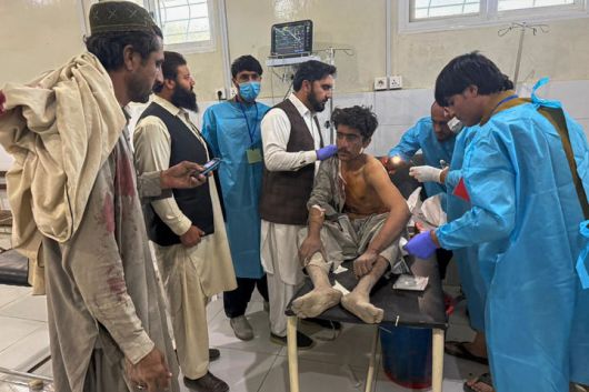[차만=AP/뉴시스] 파키스탄과 아프가니스탄의 국경 교전으로 부상한 남성이 15일(현지 시간) 파키스탄 차만의 한 병원에서 치료받고 있다. 두 나라는 48시간 임시 휴전을 정전으로 이어가기 위해 도하에서 회담을 할 것으로 아프간 정부 소식통이 전했다. 2025.10.17.
