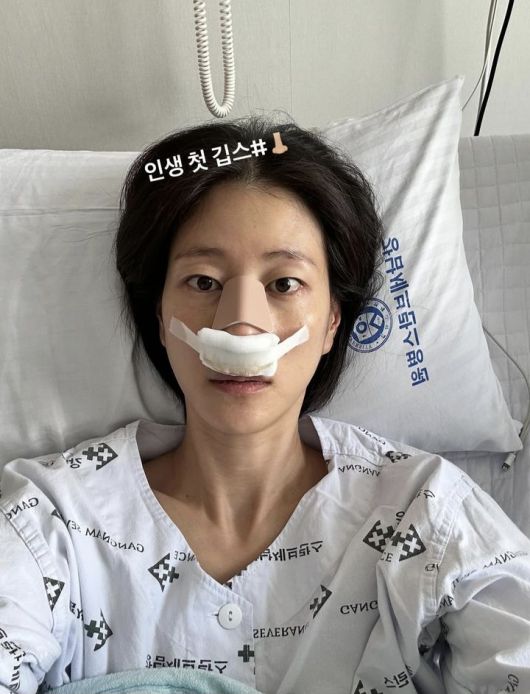 [서울=뉴시스] 모델 출신 방송인 이현이가 축구 경기 중 코뼈 골절 부상을 입었다. (사진=이현이 인스타그램 캡처) 2025.10.16. photo@newsis.com *재판매 및 DB 금지