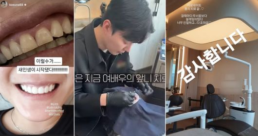 배우 고은아가 최근 제로네이트 시술 전·후 사진을 공개했다. 사진 | 고은아 SNS