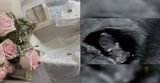 유나 인스타그램.