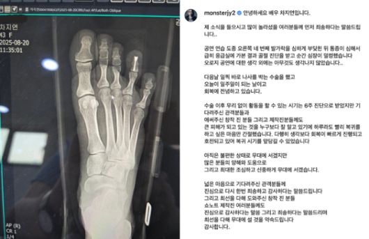 차지연이 28일 개인 SNS에 부상 당시 촬영한 X-레이와 함께 근황과 사과 인사를 전했다. 사진 | 차지연 SNS