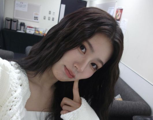 사진 | 아이들 미연 SNS