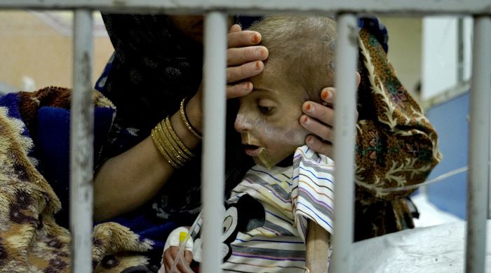 아프가니스탄 여성이 지난 5월22일 수도 카불의 한 병원에서 영양실조 치료를 받는 어린 아들의 상태를 확인하고 있다. 아프간의 병원은 영양실조로 실려온 아이들로 빈 병실이 없을 정도다. 카불 | AP연합뉴스