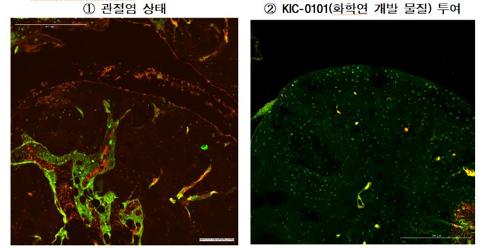 류마티스 관절염에 걸린 실험 동물의 관절 조직(왼쪽 사진)에서는 빨간색과 연두색으로 보이는 염증 단백질이 다수 확인된다. 류마티스 치료 효과가 있는 물질인 ‘KIC-0101’을 투여했더니 염증 단백질이 줄어들고 염증으로 손상된 조직이 복구됐다(오른쪽 사진). 한국화학연구원 제공