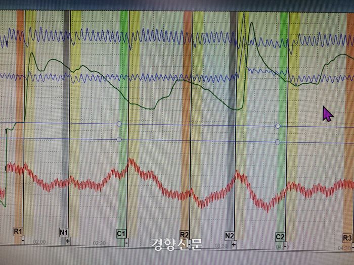 실제 폴리그래프 검사 화면이다. 파란색·초록색·빨간색 선이 흉부·복부 호흡과 심박수 등을 나타내며 생리적 반응이 거짓말을 할 때 무의식적으로 변하는 특성을 이용해 정해진 질문에 대한 답변이 진실인지 거짓인지 측정한다. 전현진 기자