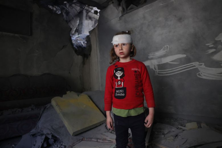 지난 16일(현지시간) 이스라엘군이 공습한 팔레스타인 가자지구 북부 자발리아 난민캠프에서 머리에 붕대를 감은 소녀가 집 안을 둘러보고 있다. AFP연합뉴스