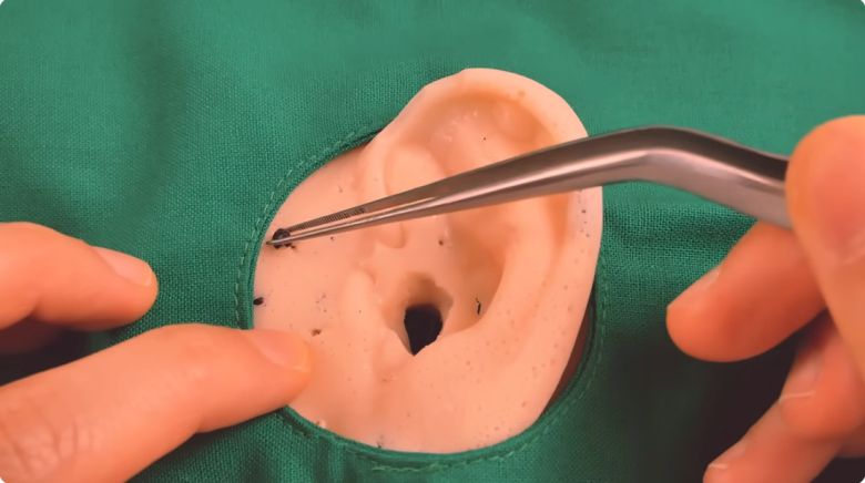 유튜버 하쁠리가 올린 ASMR 영상의 한 장면. 귀에 박힌 돌을 핀셋으로 뽑는 상황을 ASMR로 만들었다. 유튜브채널 하쁠리 영상 캡처