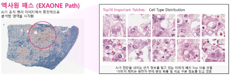 LG AI연구원의 차세대 정밀 의료 인공지능(AI) 모델인 엑사원 패스는 전체 슬라이드 이미지(WSI)에서 암과 관련된 유전자 변이를 예측할 수 있다. LG AI연구원 제공