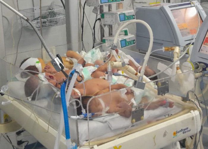 가자지구의 한 병원에서 연료와 장비 부족으로 4명의 신생아가 하나의 인큐베이터에 들어가 치료받고 있다. 파델 나임 엑스 계정