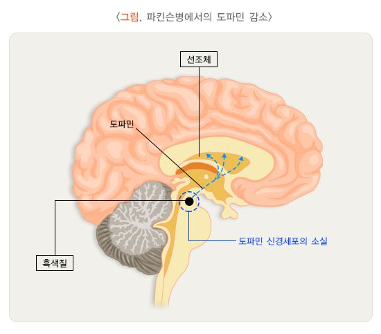 도파민 분비가 감소된 뇌 속 구조. 질병관리청 제공
