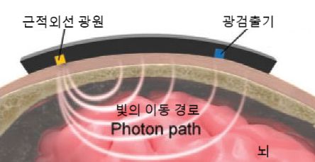 이마에 부착한 무선 근적외선 분광기가 두개골을 투과한 근적외선 광선을 통해 내부 수분량과 노폐물 세척 정도를 측정하는 방식을 묘사한 모식도. 분당서울대병원 제공