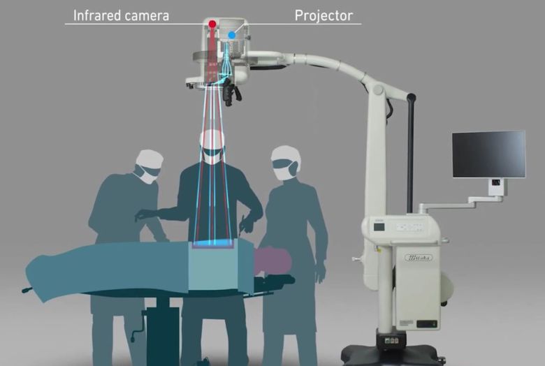 MIPS의 개념도. 출처=파나소닉
