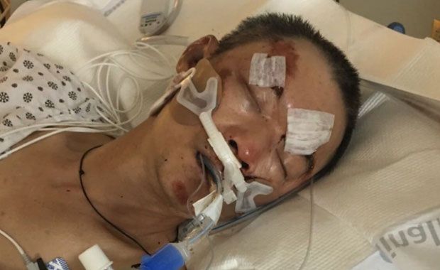 뇌출혈과 안면 골절상 등 심각한 부상이 확인된 마씨는 빠른 회복을 위해 유도된 혼수상태로 치료에 들어갔다. 하지만 상태는 여전히 위독하다.