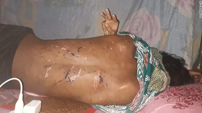 미얀마 군사 구금 수용소에서 3일을 보내며 떠올리기조차 어려운 끔찍한 고문을 받은 뒤 풀려난 19세 청년.