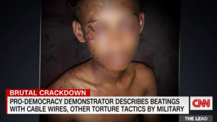 미얀마 군사 구금 수용소에서 3일을 보내며 떠올리기조차 어려운 끔찍한 고문을 받은 뒤 풀려난 19세 청년.